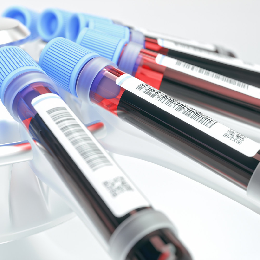 Genetik Test & Analiz